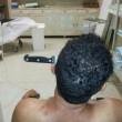 Contadino con coltello conficcato per 10 cm nel cranio01