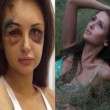 Alexandra Sereda, modella russa sfigurata dall’ex fidanzato milionario 3
