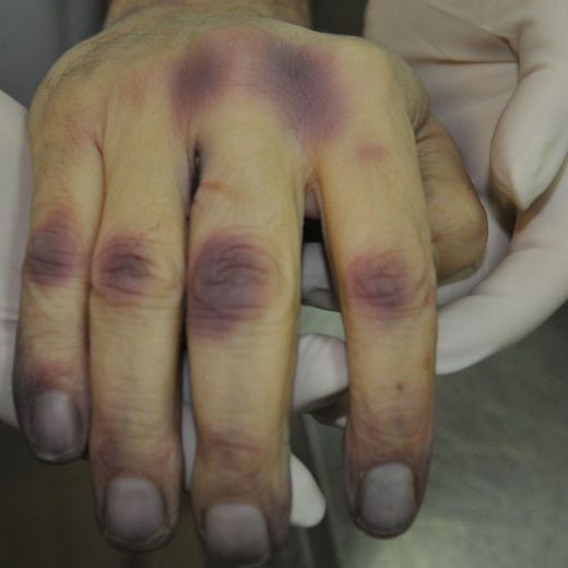 riccardo magherini salma 04