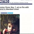 Preston Flores bruciato a 7 anni in strada dai bulli in Scozia01