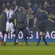 Paul Pogba infortunato in lacrime, rischia un mese di stop 02