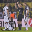 Paul Pogba infortunato in lacrime, rischia un mese di stop 03