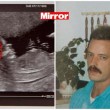 Ecografia con sorpresa..."C'è il volto di mio padre morto" FOTO
