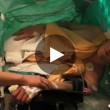 VIDEO YouTube canta Shubert mentre lo operano al cervello4