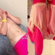 A 5 anni resta col pene incastrato nel costume da bagno e...04
