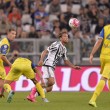 Juventus: Claudio Marchisio infortunato, un mese fermo