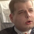 Il più grande trapianto di faccia mai eseguito6