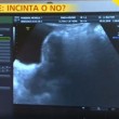 Michelle Hunziker ecografia in tv: "Non sono incinta" VIDEO 6