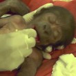 Ginecologo fa partorire gorilla col cesareo6