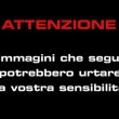 Pozzuoli, denuncia choc: "Finanziere mi ha staccato naso a morsi"01