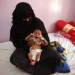 Udai Faisal, bimbo 5 mesi morto di fame in Yemen. FOTO choc04