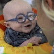 Bimbo quasi cieco vede la mamma per la prima volta