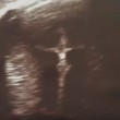 YOUTUBE "Gesù nell'ecografia": misteriosa croce...