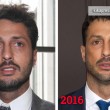 Fabrizio Corona, zigomi e denti rifatti. Ironia sul web FOTO