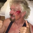 Richard Branson, incidente in bici: "Ho pensato che stavo per morire" FOTO 6