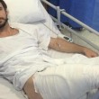 Cade dalla bici e l'iPhone gli esplode in tasca: ustionato ciclista