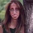 Lizzie Velasquez, le sue foto usate per meme crudeli. Lei reagisce così01