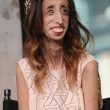 Lizzie Velasquez, le sue foto usate per meme crudeli. Lei reagisce così04