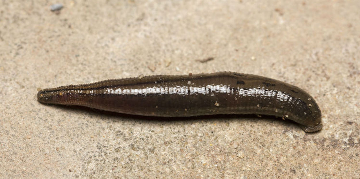 Bambina fatica a respirare: aveva una sanguisuga in gola