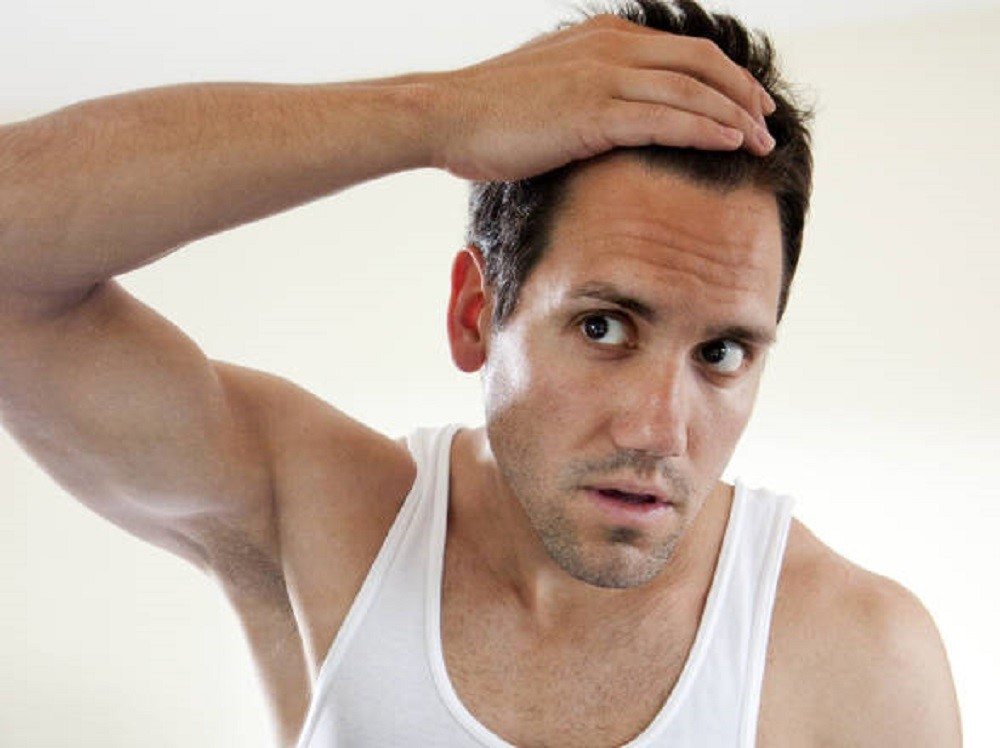 Trapianto di capelli, come funziona? Tutto quello che devi sapere