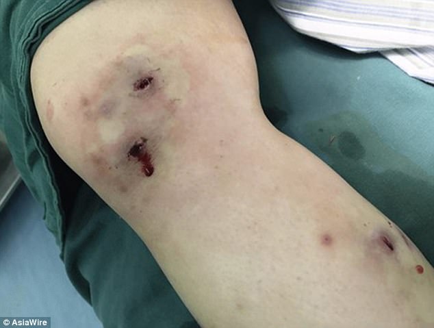 Punta in Brasile da uno strano insetto