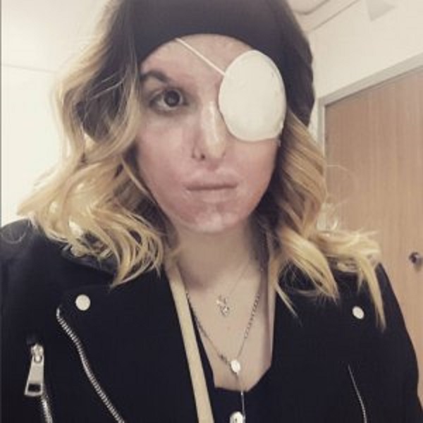 Gessica Notaro in aula con l'ex fidanzato che l'ha sfregiata: mostra ferite, poi ha un malore