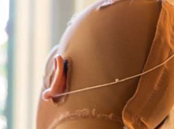 Gessica Notaro, prime FOTO dell'ex Miss Italia sfregiata dall'acido