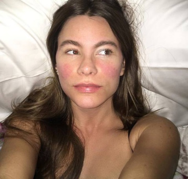 Sofia Vergara, la foto su Instagram con la febbre a 39. Irriconoscibile 05