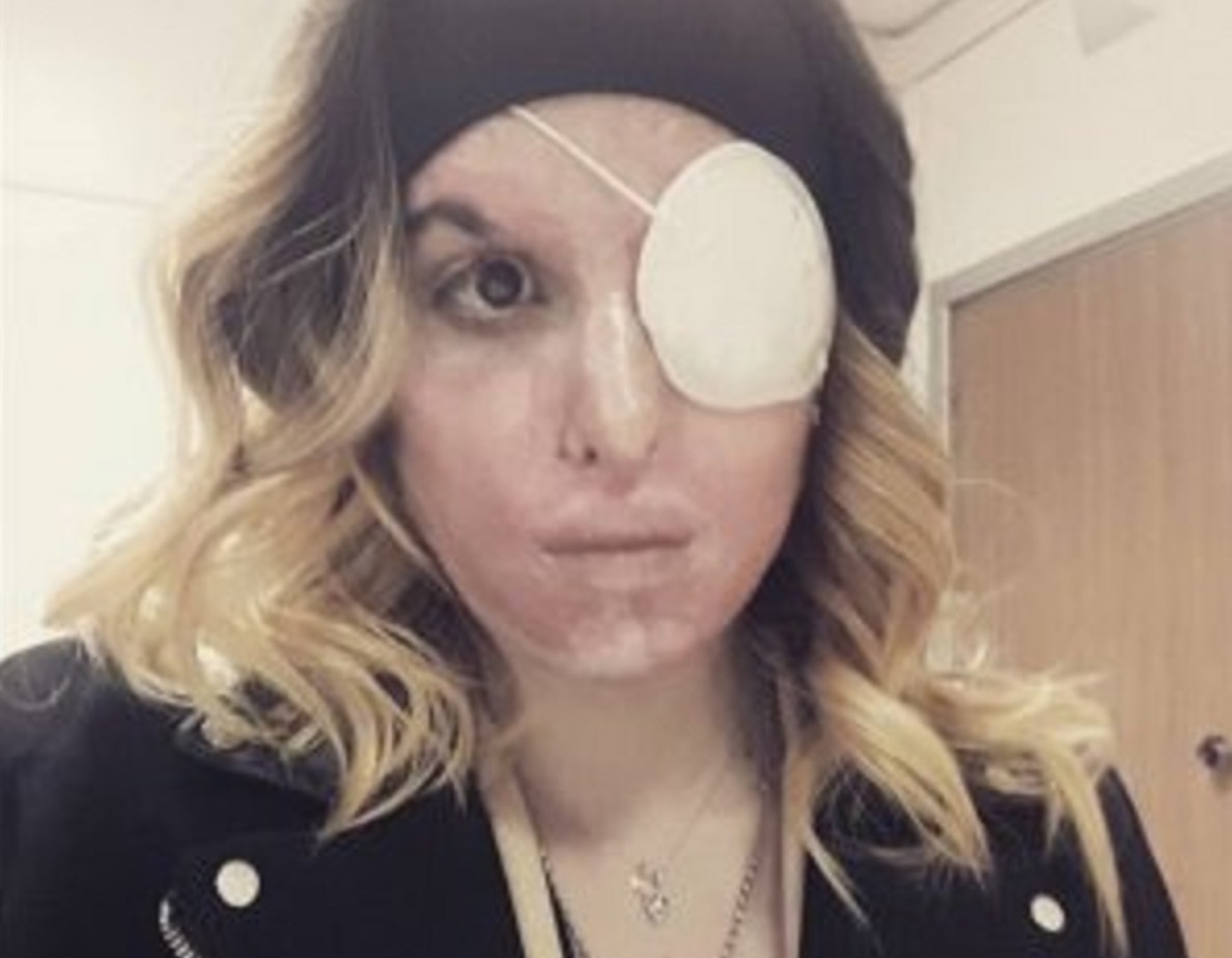 Gessica Notaro sfregiata, parla l'altra ex di Eddy Tavares: "Lui cattivo? Non pensavo arrivasse a tanto"