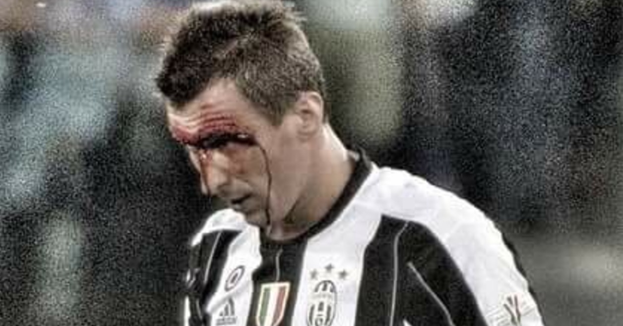 Juventus-Lazio, Mandzukic sanguinante durante finale Coppa Italia