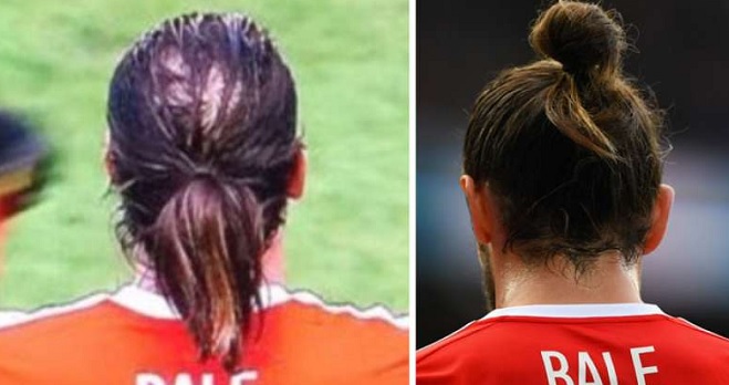 Chignon maschile contro la calvizie: copre il buco, ma è davvero bello?