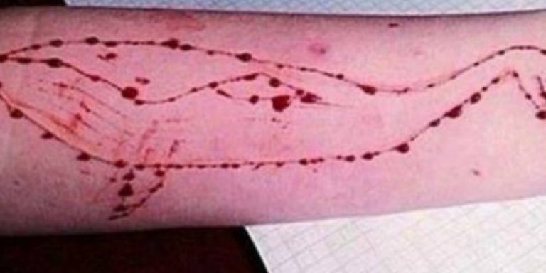 Blue Whale, le "regole di ingaggio" della sfida più pericolosa del web
