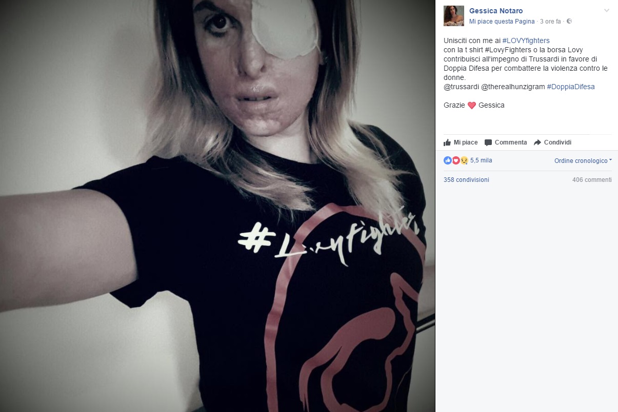 Gessica Notaro, un selfie su Facebook contro la violenza sulle donne FOTO
