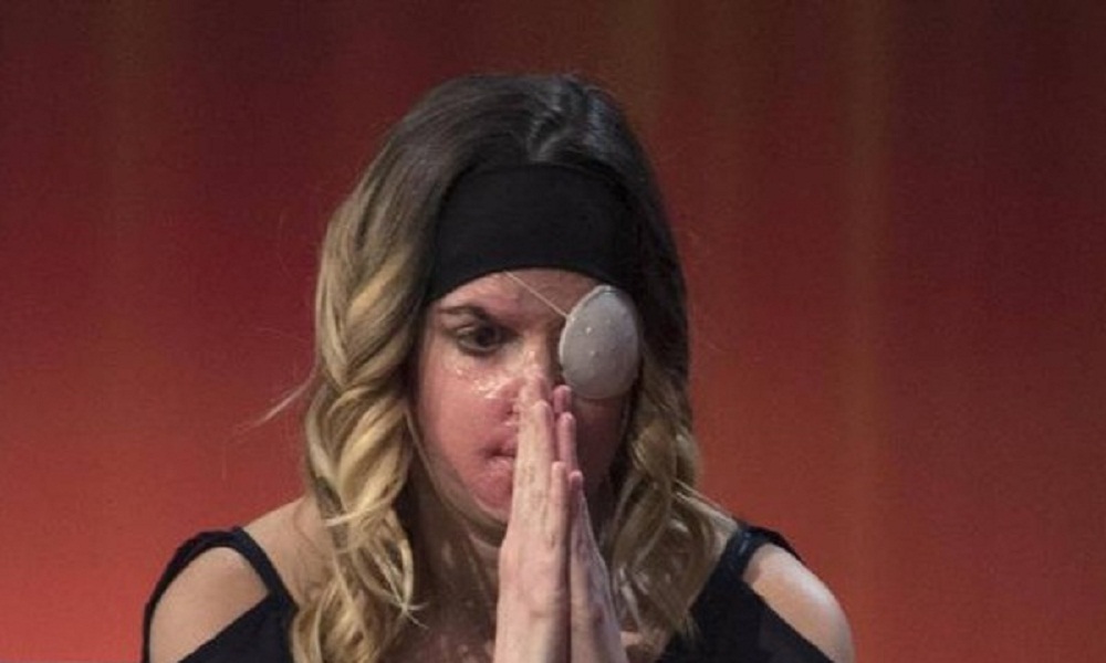 Gessica Notaro (foto Ansa)