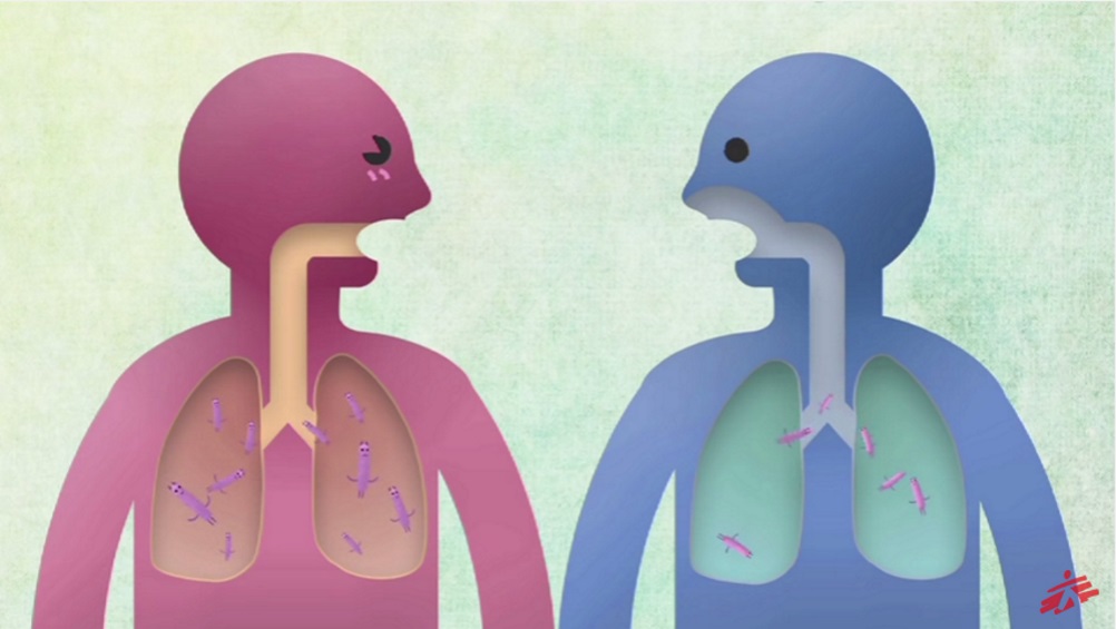 Italia, il sistema sanitario è tra i migliori al mondo: sopra a Usa e Germania