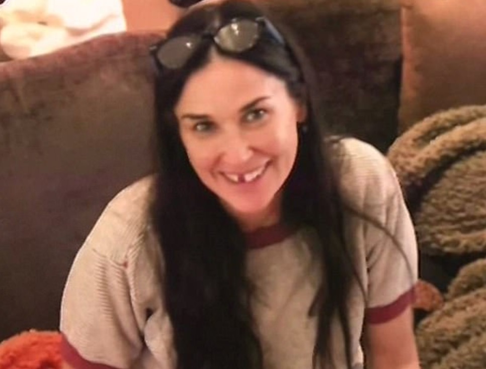 YOUTUBE Demi Moore perde due denti: "E' stato lo stress". Ma non è la prima volta...