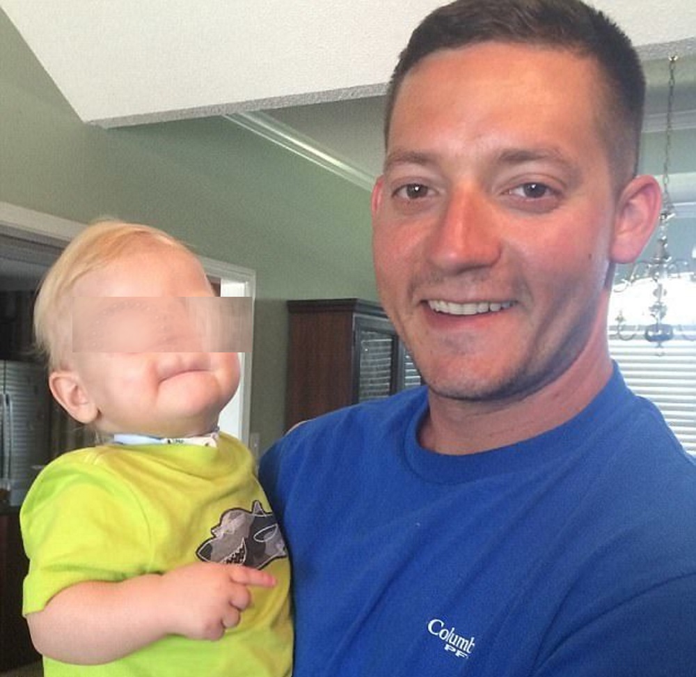 Eli Thompson, morto a 2 anni il bimbo nato senza naso