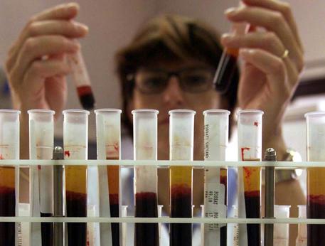 Mucca pazza, 3 casi sospetti in 5 mesi a Roma, Padova e Pistoia