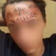 Credono erroneamente che sia un criminale, gli tatuano "ladro" sulla fronte