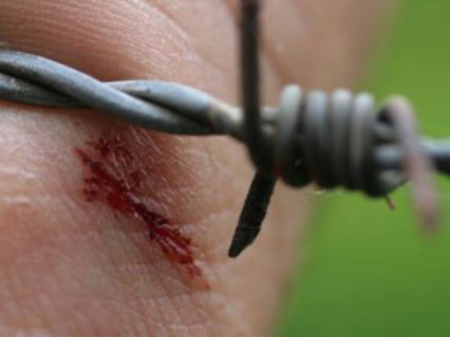 Tetano dopo il morbillo "resuscitato" dai no-vaccini. In Sardegna primo caso dopo 30 anni