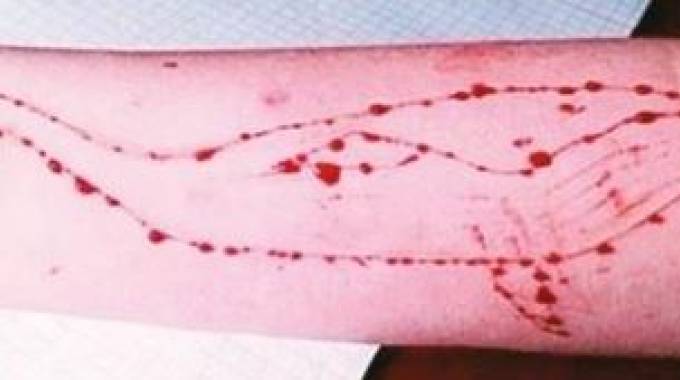 Blue Whale, giovane indagata a Milano per istigazione al suicidio di una ragazzina di 12 anni