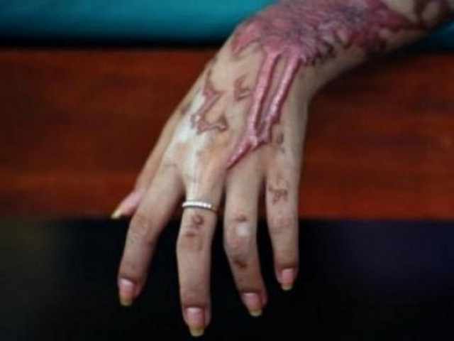 Londra, rapine con acido: 5 feriti in meno di 2 ore, arrestato un adolescente