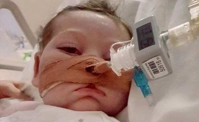 Charlie Gard: specialista Usa non convince i medici inglesi. Gli americani però gli danno la cittadinanza