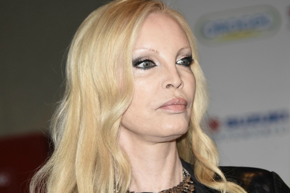 Patty Pravo, incidente in Salento: cade e si frattura una spalla