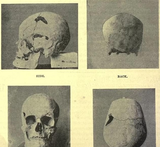 Sa-nakht, faraone egiziano di 4700 anni fa soffriva di gigantismo