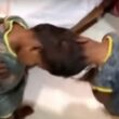 Gemelle sianesi attaccate dalla testa, separati dopo operazione di 20 ore