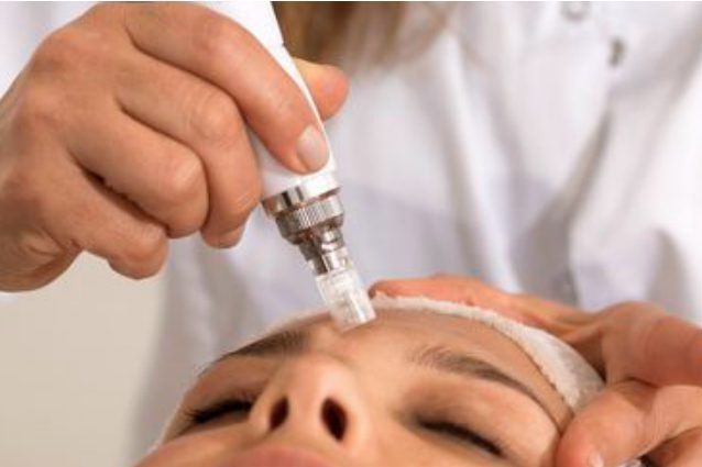 "Sentivo puzza di carne bruciata": il laser le rovina il viso