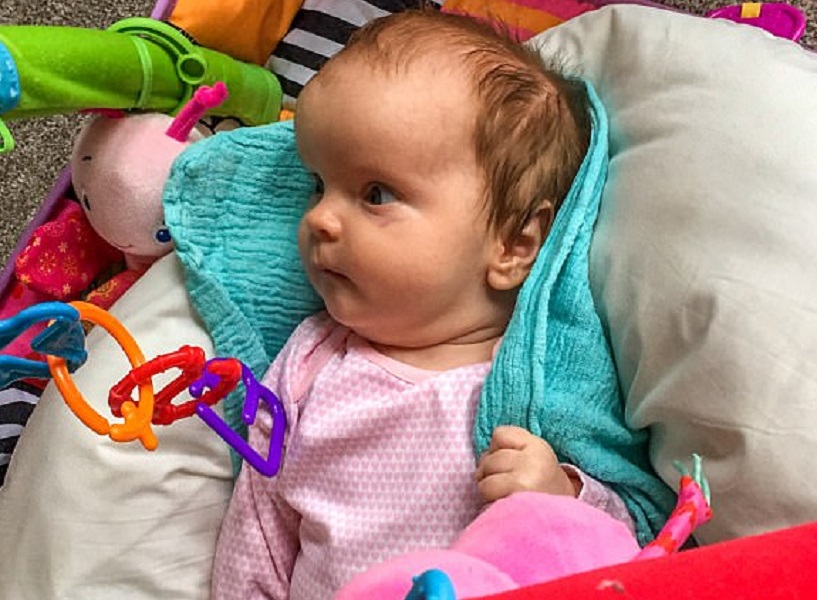 Lucy non ha più la testa a forma di alieno FOTO: a 17 mesi potrà avere una vita normale