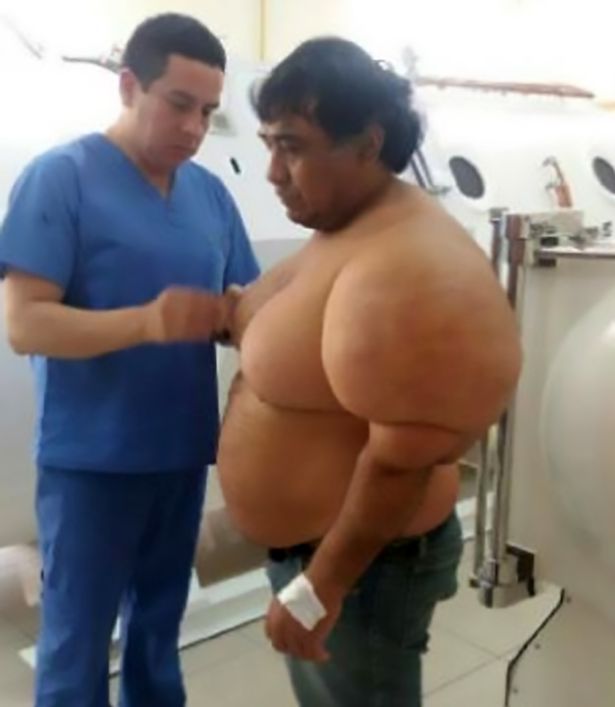 Sub risale in superficie troppo in fretta, ecco cosa gli accade