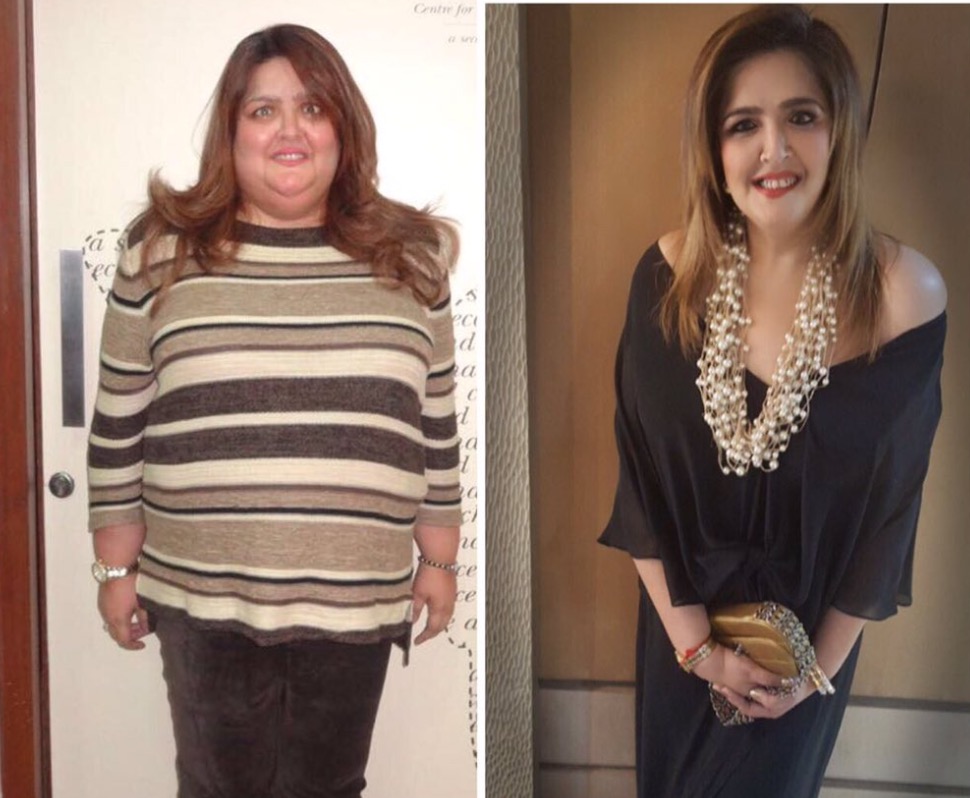 Obesa, non riusciva a dimagrire perché depressa. "Ecco cosa mi ha salvata"